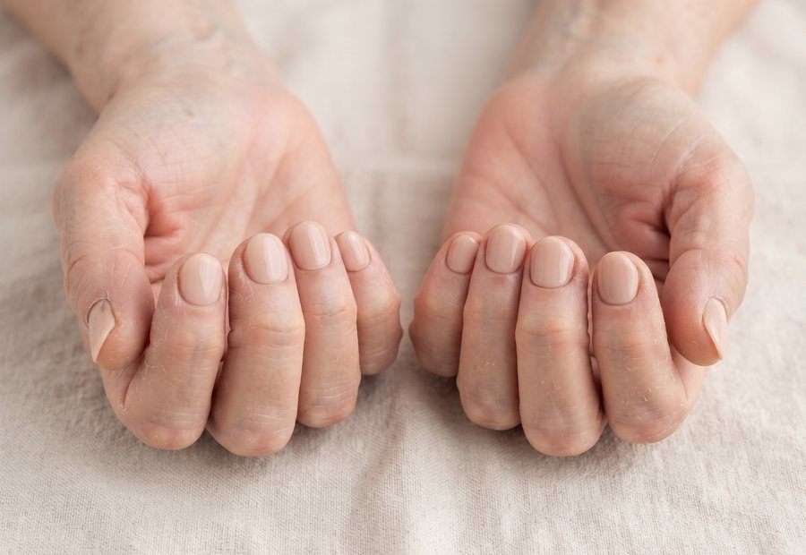 Dieselben Hände nach der Maniküre