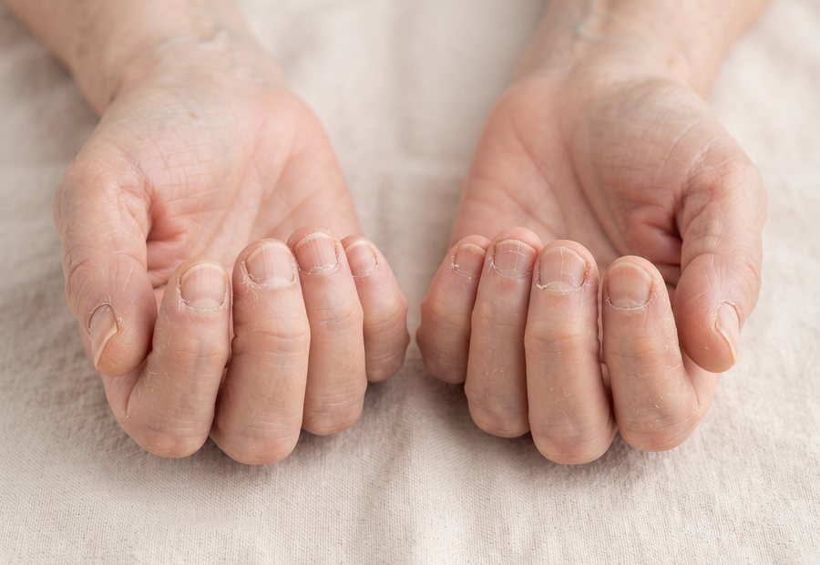 Hände vor der Behandlung